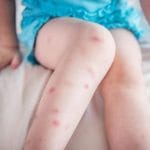 Bed Bugs Control Services